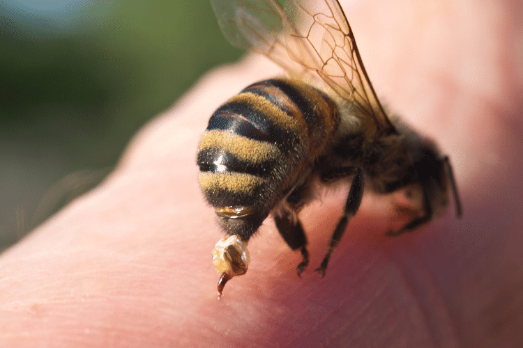 Close-up of a bee sting on a man's hand